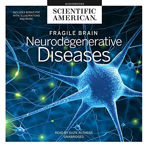 Fragile Brain by Scientific American