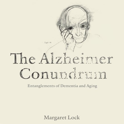 The Alzheimer Conundrum by Margaret Lock