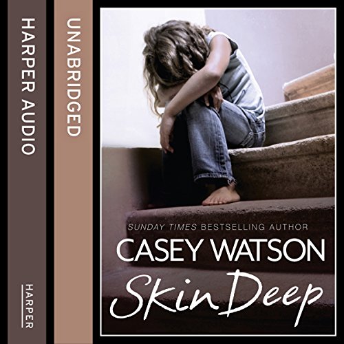 Skin Deep by Casey Watson