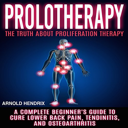 Prolotherapy: The Truth About Proliferation Therapy
