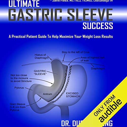 Ultimate Gastric Sleeve Success by Duc C. Vuong