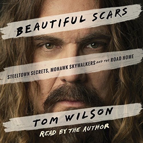 Beautiful Scars by Tom Wilson