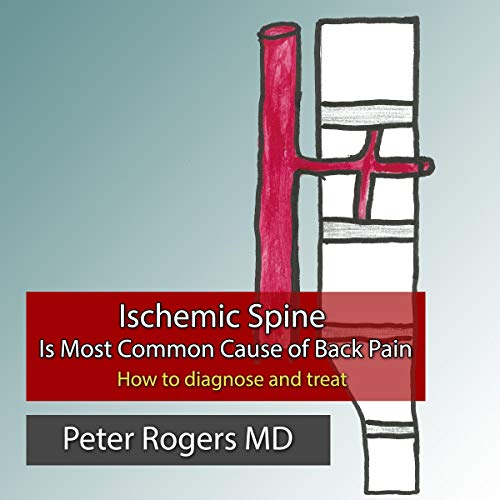 Ischemic Spine Is Most Common Cause of Back Pain: How to Diagnose and Treat