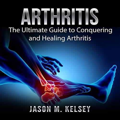 Arthritis