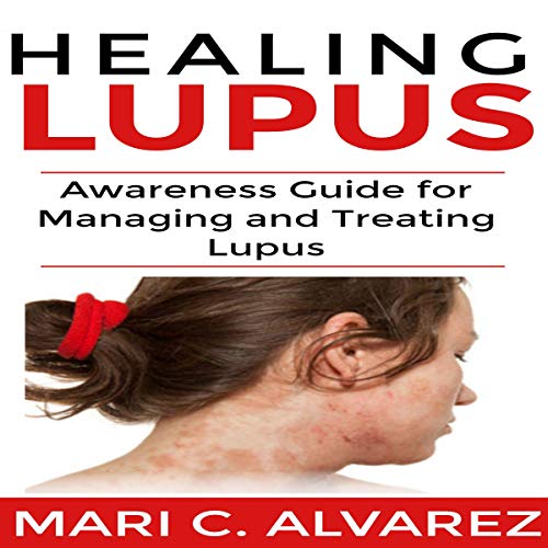 Healing Lupus