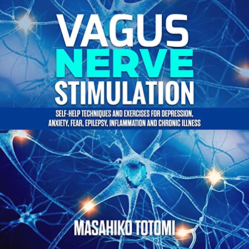 Vagus Nerve Stimulation