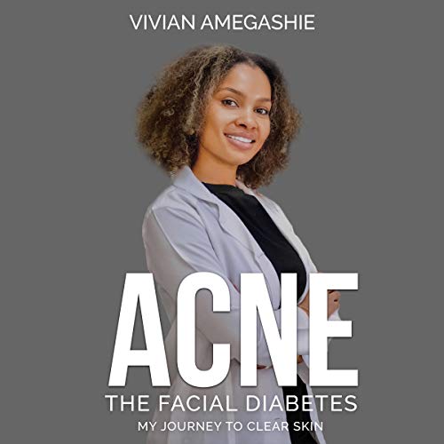 Acne: The Facial Diabetes