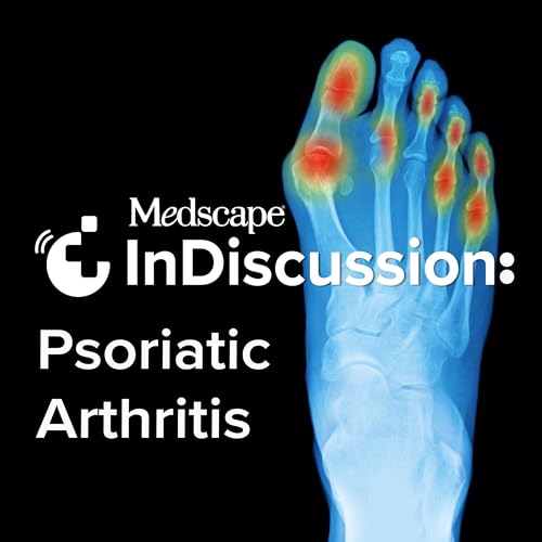 Medscape InDiscussion: Psoriatic Arthritis