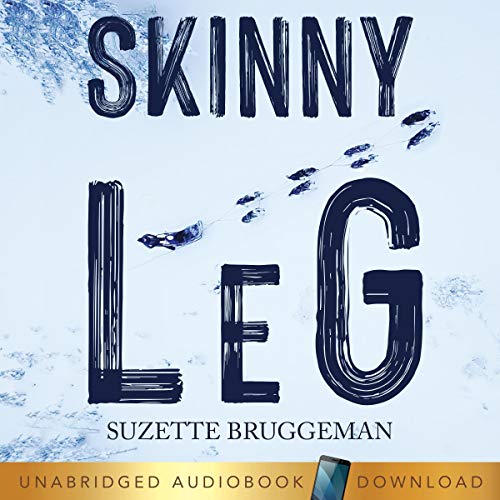 Skinny Leg by Suzette Bruggeman