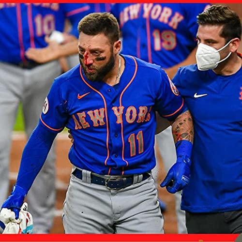 MLB: Kevin Pillar recibe pelotazo en la cara by Unknown