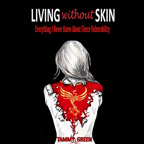 Living Without Skin by Tammy Green