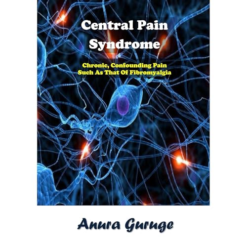 Central Pain Syndrome by Anura Guruge