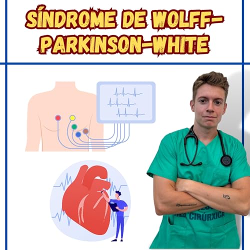 Capítulo 190: Síndrome de Wolff-Parkinson-White by Unknown