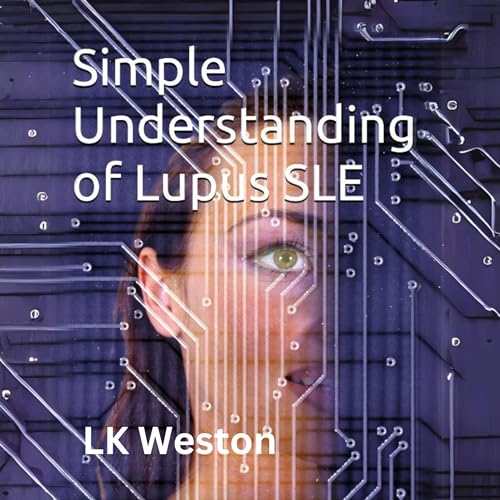 Simple Understanding of Lupus SLE