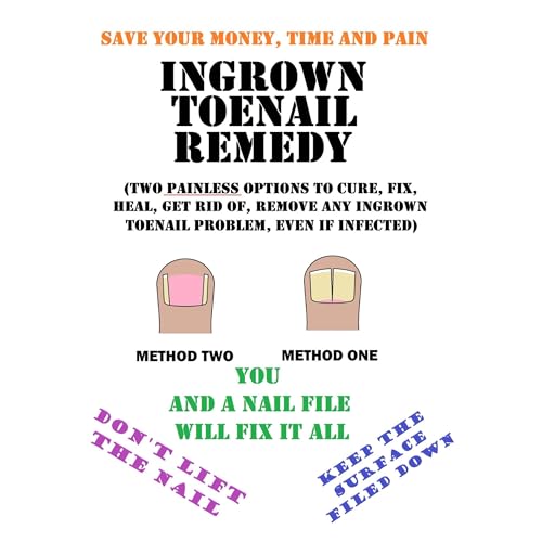Ingrown Toenail Remedy