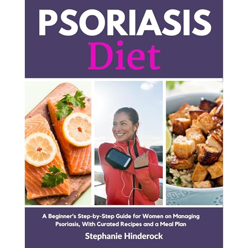 Psoriasis Diet: A Beginner's Step-by-Step Guide for Women on Managing Psoriasis, With Curated Recipes and a Meal Plan by Stephanie Hinderock