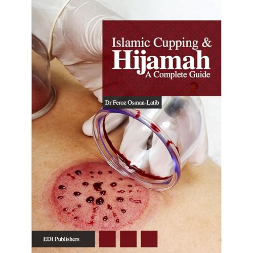 Islamic Cupping & Hijamah: A Complete Guide by Dr Feroz Osman-Latib