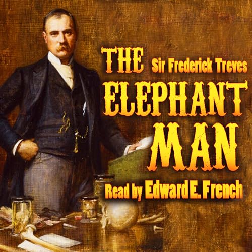 The Elephant Man