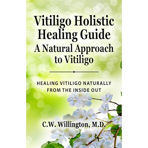 Vitiligo Holistic Healing Guide - A Natural Approach to Vitiligo