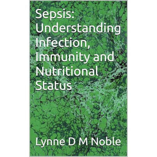 Sepsis: Understanding Infection, Immunity and Nutritional Status