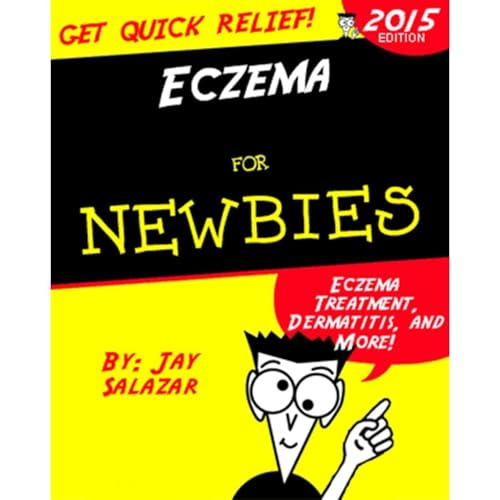 Eczema for Newbies by Jay Salazar