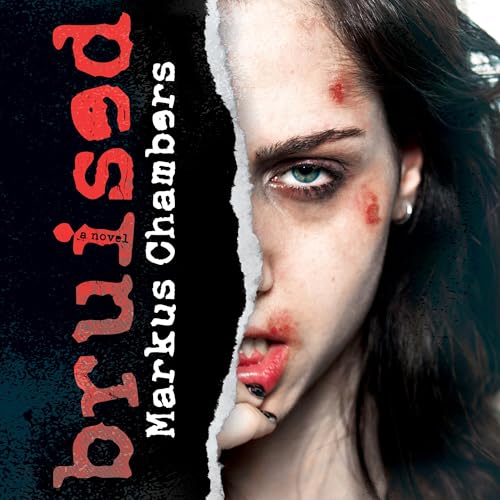 Bruised by Markus Chambers