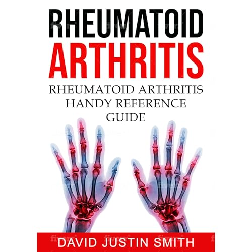 Rheumatoid Arthritis:Rheumatoid Arthritis Handy Reference Guide(Acute rheumatoid arthritis, alternative treatment for rheumatoid arthritis,arthritis vs rheumatoid arthritis)