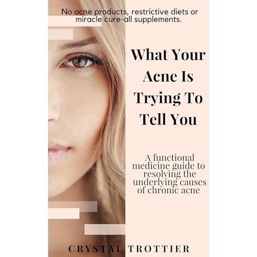 What Your Acne is Trying to Tell You by Crystal Trottier