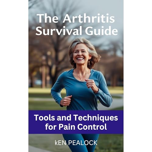 The Arthritis Survival Guide