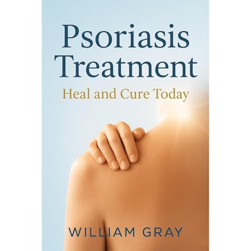 Psoriasis Treatment
