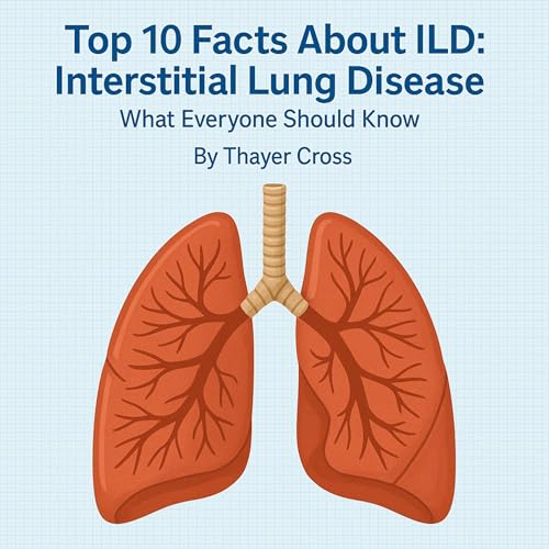 Top 10 Facts About ILD: Interstitial Lung Disease What Everyone Should Know by Thayer Cross