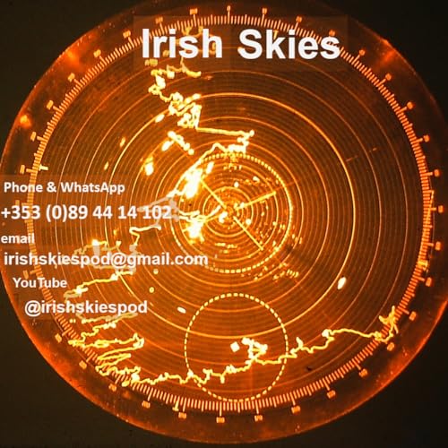 Irish Skies Pod by Mick Campbell