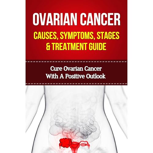 Ovarian Cancer Causes, Symptoms, Stages & Treatment Guide