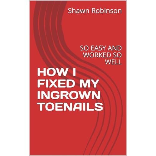 HOW I FIXED MY INGROWN TOENAILS