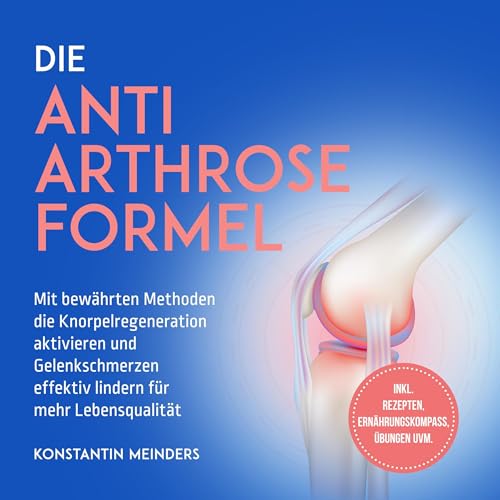 Die Anti Arthrose Formel