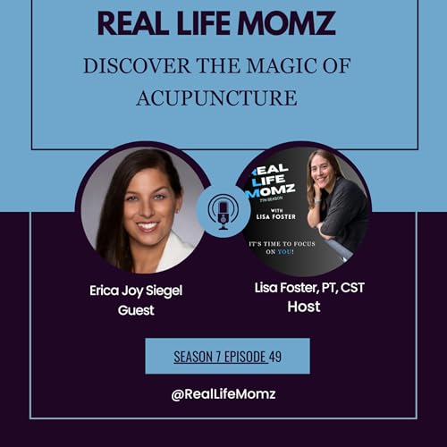 Discover the Magic of Acupuncture with Erica Siegel by Unknown
