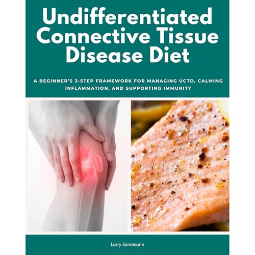 Undifferentiated Connective Tissue Disease Diet: A Beginner’s 3-Step Framework for Managing UCTD, Calming Inflammation, and Supporting Immunity by Larry Jamesonn