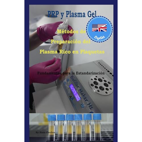 Preparation methods Platelet rich plasma. by Hanz Flechas