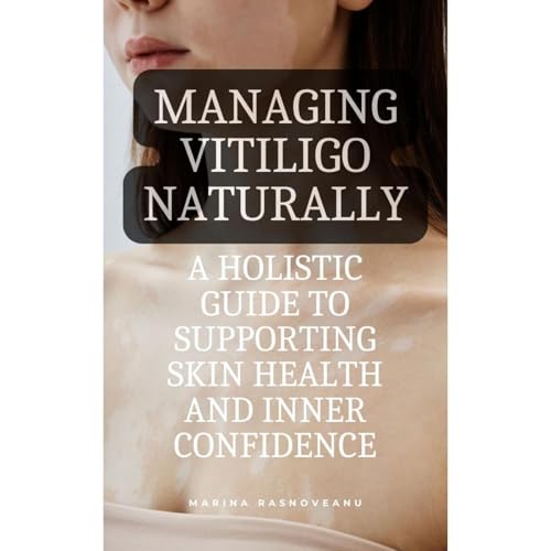 Managing Vitiligo Naturally: A Holistic Guide to Supporting Skin Health and Inner Confidence by Marina Rasnoveanu