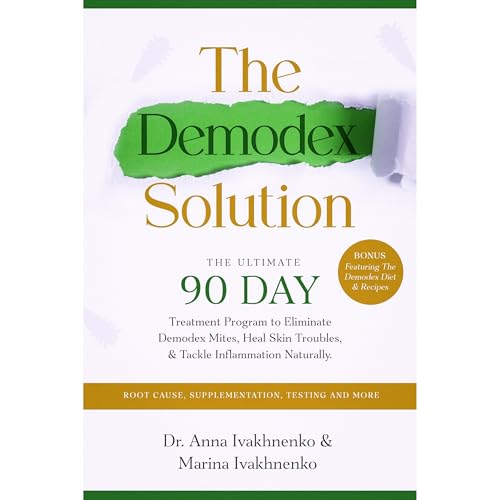 THE DEMODEX SOLUTION by Marina Ivakhnenko