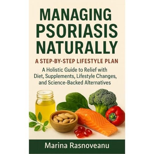Managing Psoriasis Naturally – A Step-by-Step Lifestyle Plan by Marina Rasnoveanu