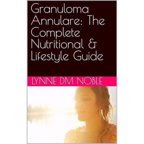 Granuloma Annulare: The Complete Nutritional & Lifestyle Guide