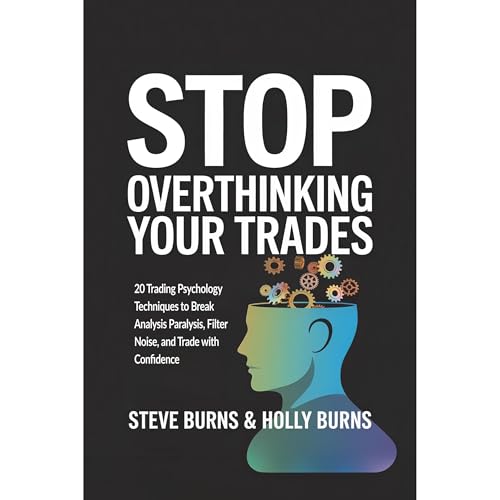 Stop Overthinking Your Trades by Steve Burns